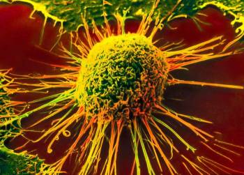 Почему опухоль имеет название «рак»